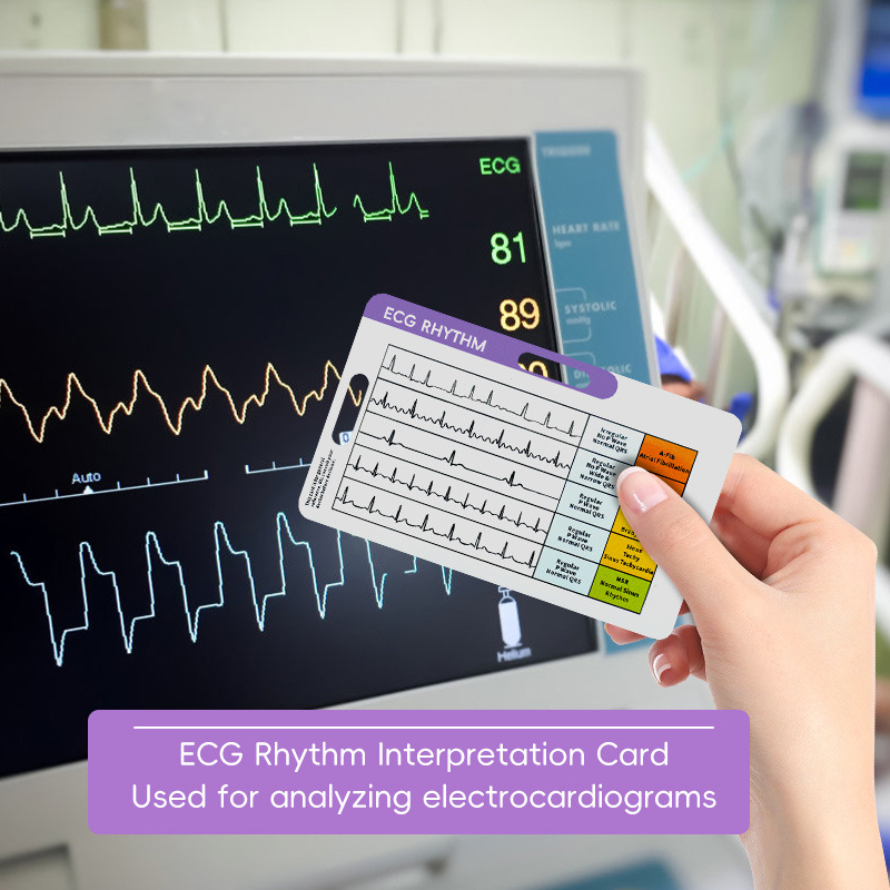 ECG Interpretation Cheat Sheet - Photography Cheat Sheet 评论和价格